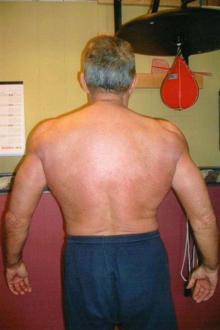 Are You SkinnyFat? A Comprehensive Description of the SkinnyFat BodyType